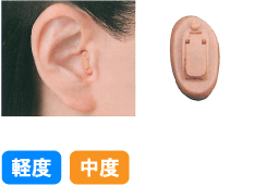 耳型タイプ1