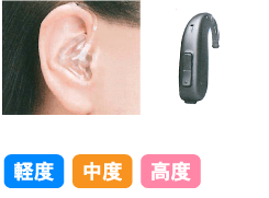 耳型タイプ1