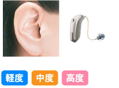耳型タイプ1